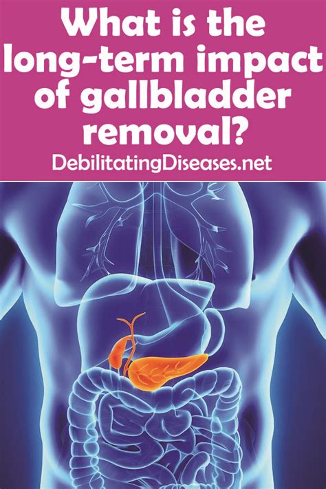 Don't Let Gallbladder Operation Side Effects Take Over Your Life - Understand the Risks and Take Control!